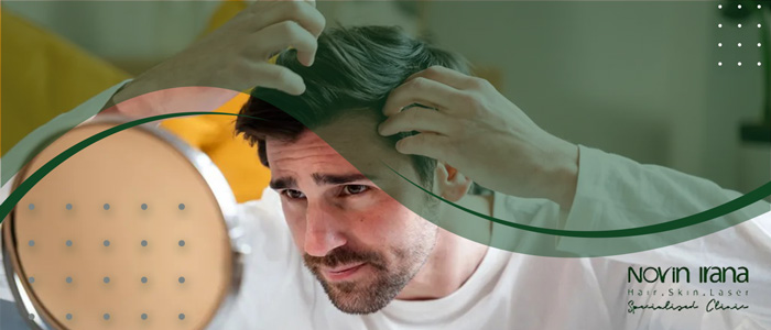چه نوع ریزشی با کاشت مو قابل درمان نیست