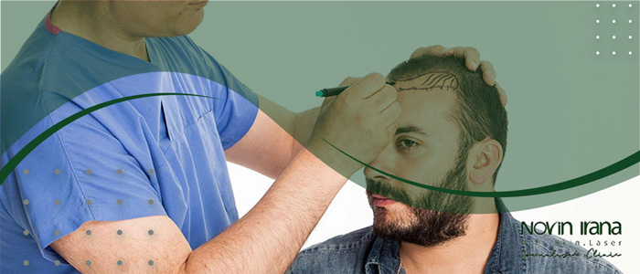 اصطلاحات پزشکی کاشت مو