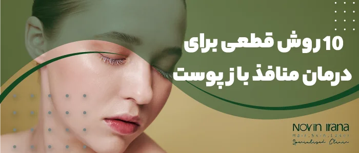 عکس منافذ باز صورت