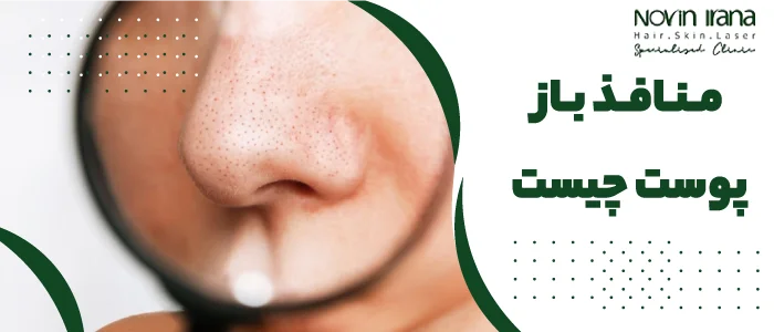 منافذ باز پوست