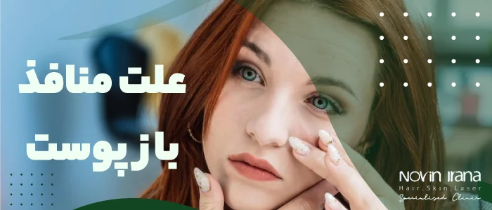 دلیل منافذ باز پوست