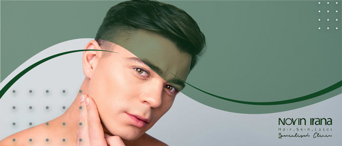 نحوه لیزر خط ریش آقایان