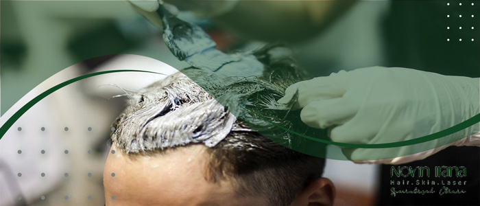 صبغ الشعر قبل عملية زراعة الشعر