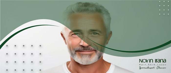 هل يمكن منع تبييض الشعر المزروع