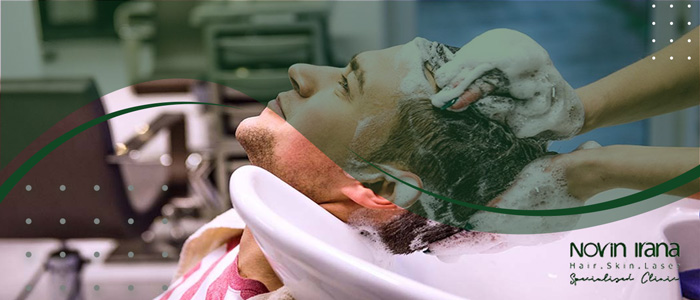 متى يمكن الاستحمام بعد زراعة الشعر