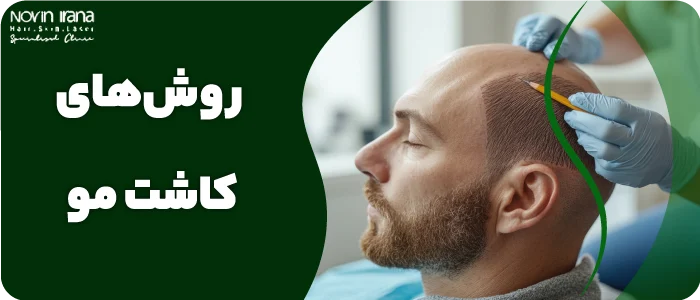قیمت کاشت هر تار مو