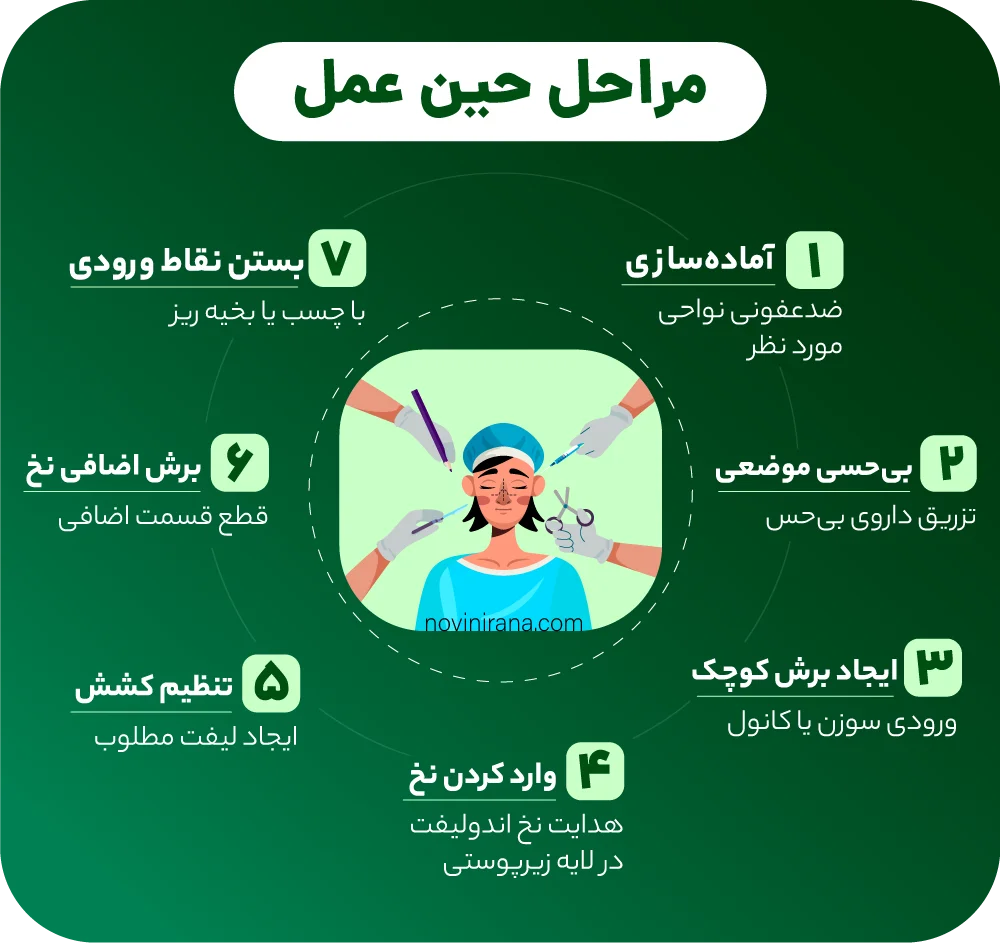 مراحل انجام اندولیفت در کلینیک نوین ایرانا