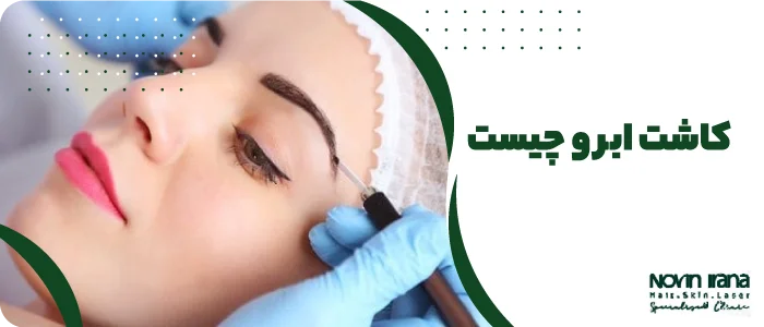 کاشت ابرو چیست؟