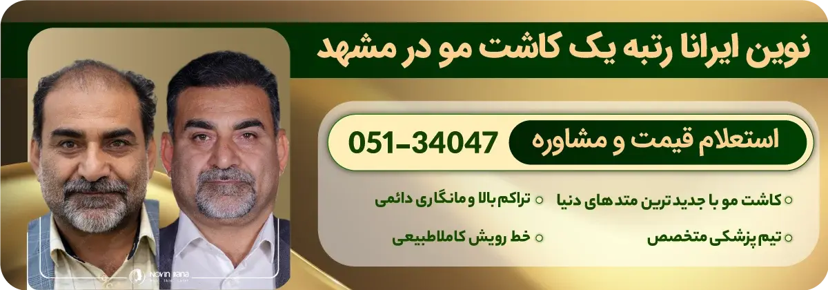هزینه کاشت مو در مشهد - جدول قیمت ۱۴۰۴ + شرایط اقساطی