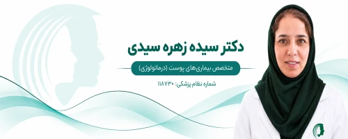 زهره سیدی دکتر بلفاروپلاستی در مشهد