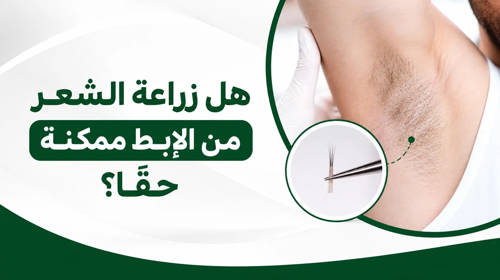 هل زراعة الشعر من الإبط ممكنة حقاً؟