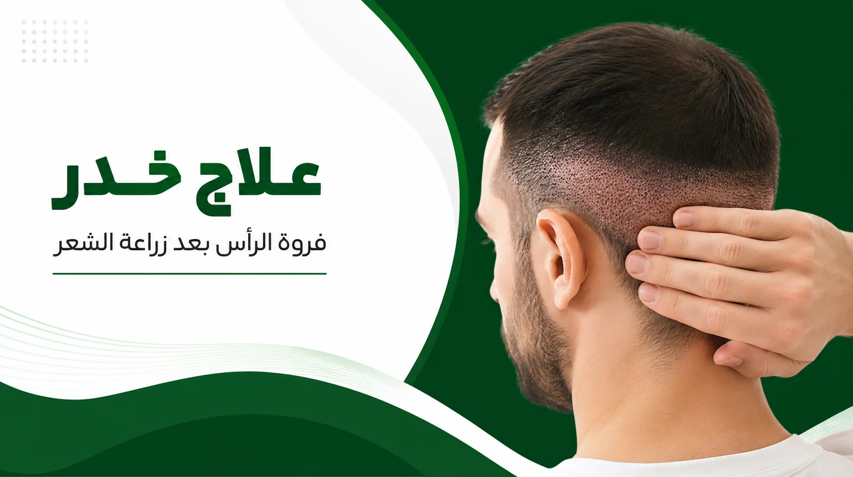 علاج خدر فروة الرأس بعد زراعة الشعر