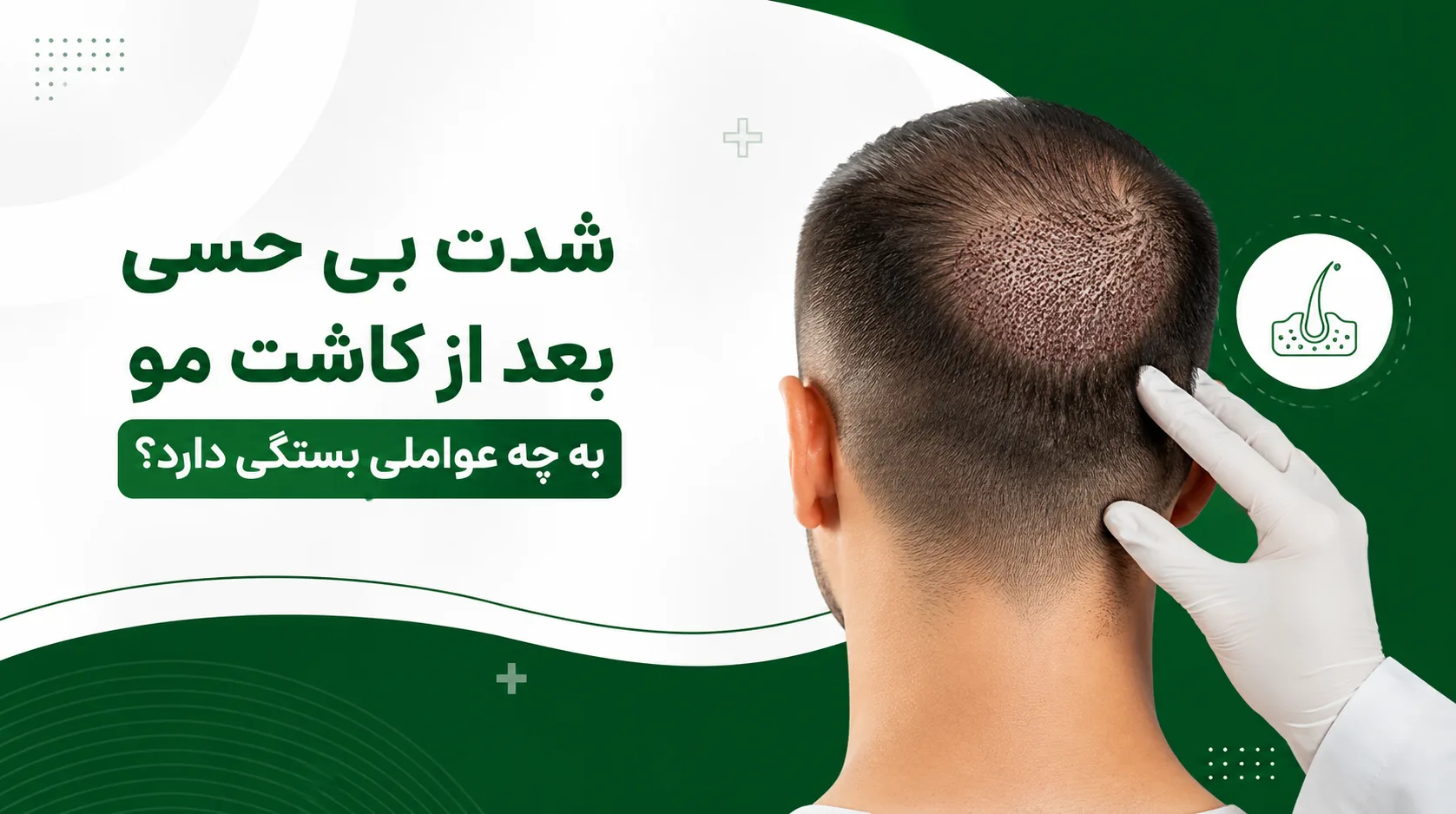 شدت بی حسی بعد از کاشت مو به چه عواملی بستگی دارد؟