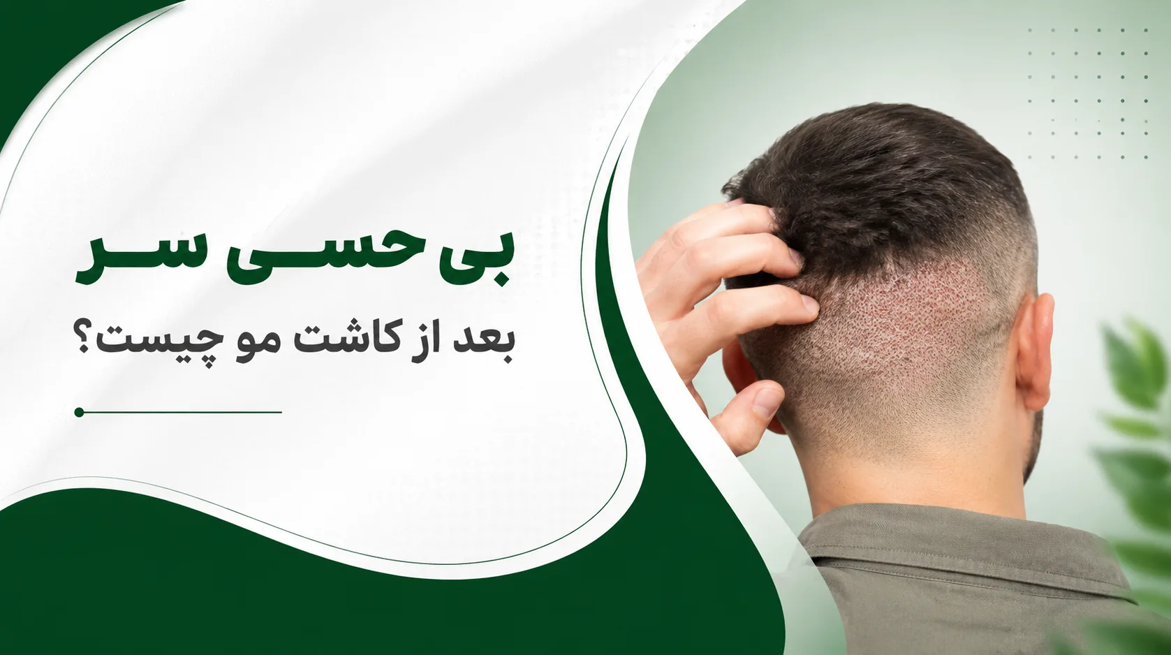 بی حسی سر بعد از کاشت مو چیست؟