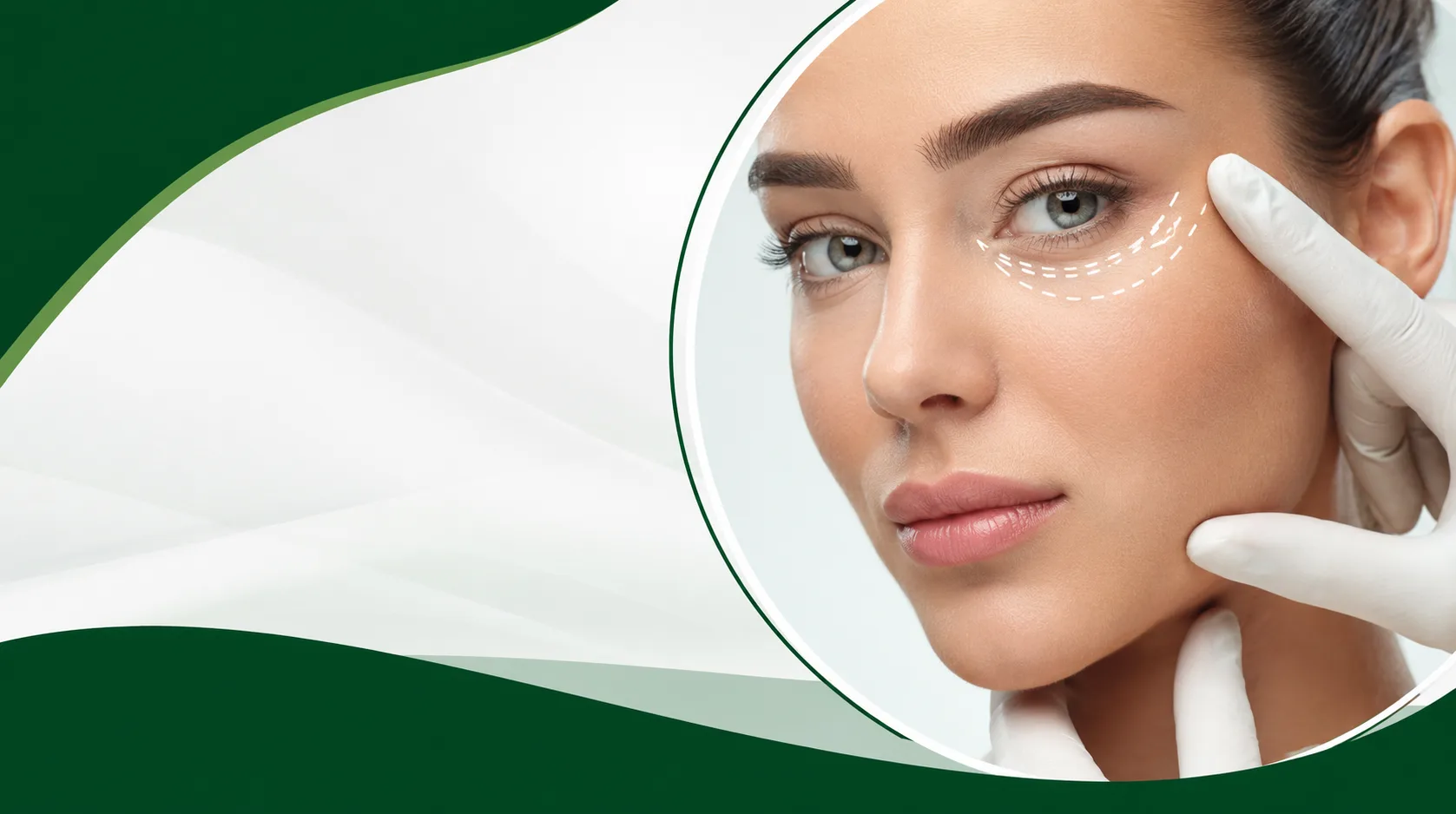 بلفاروپلاستی غیر جراحی چیست؟