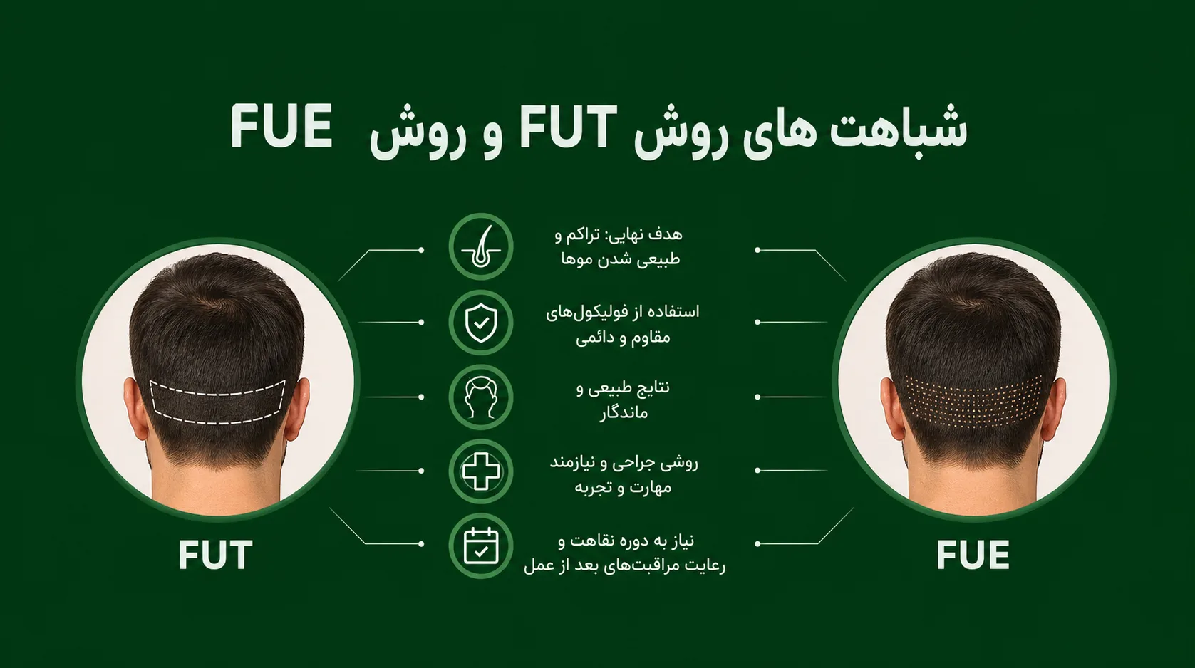 شباهت های روش FUT و روش FUE