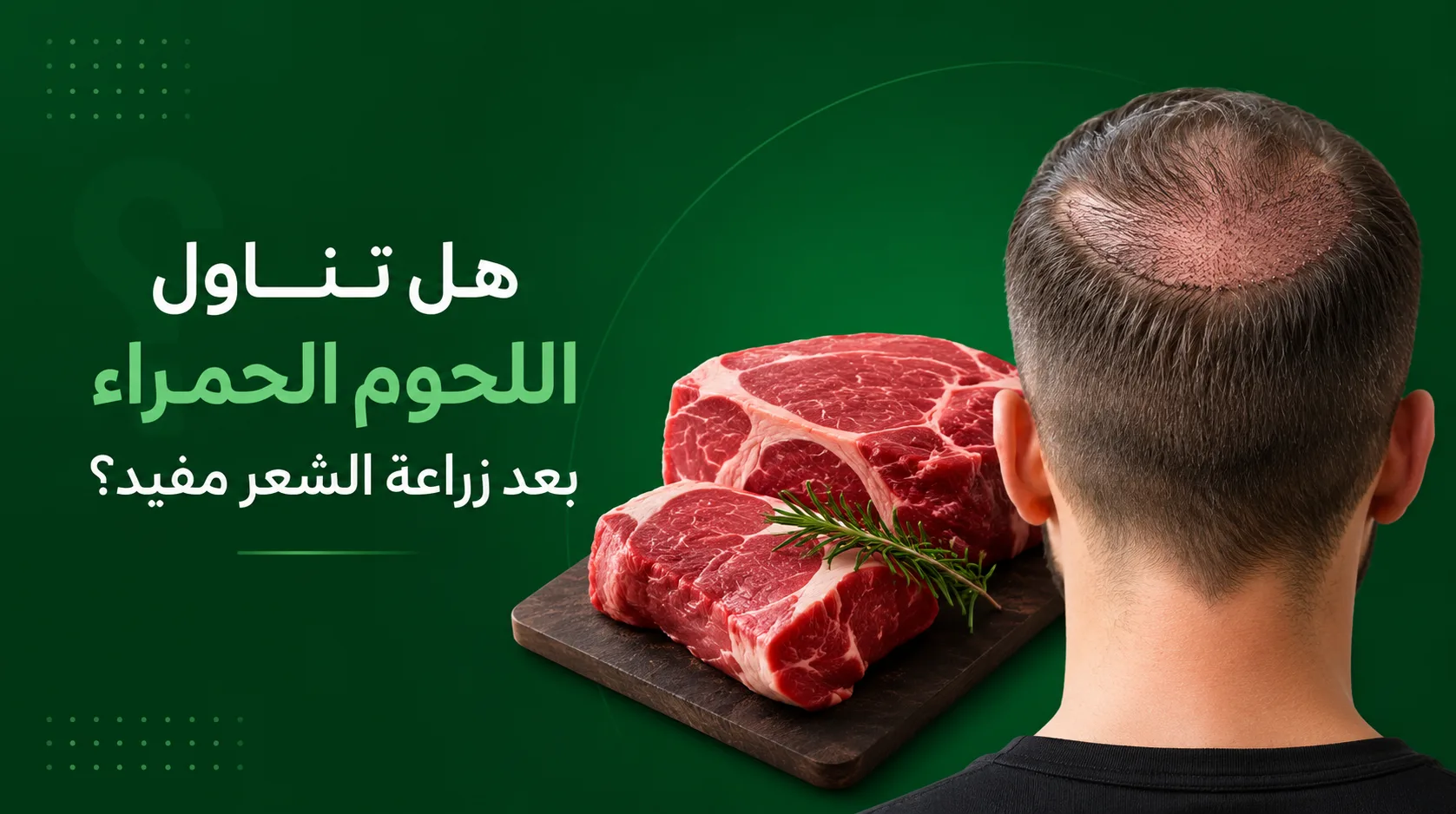 هل تناول اللحوم الحمراء بعد زراعة الشعر مفيد؟