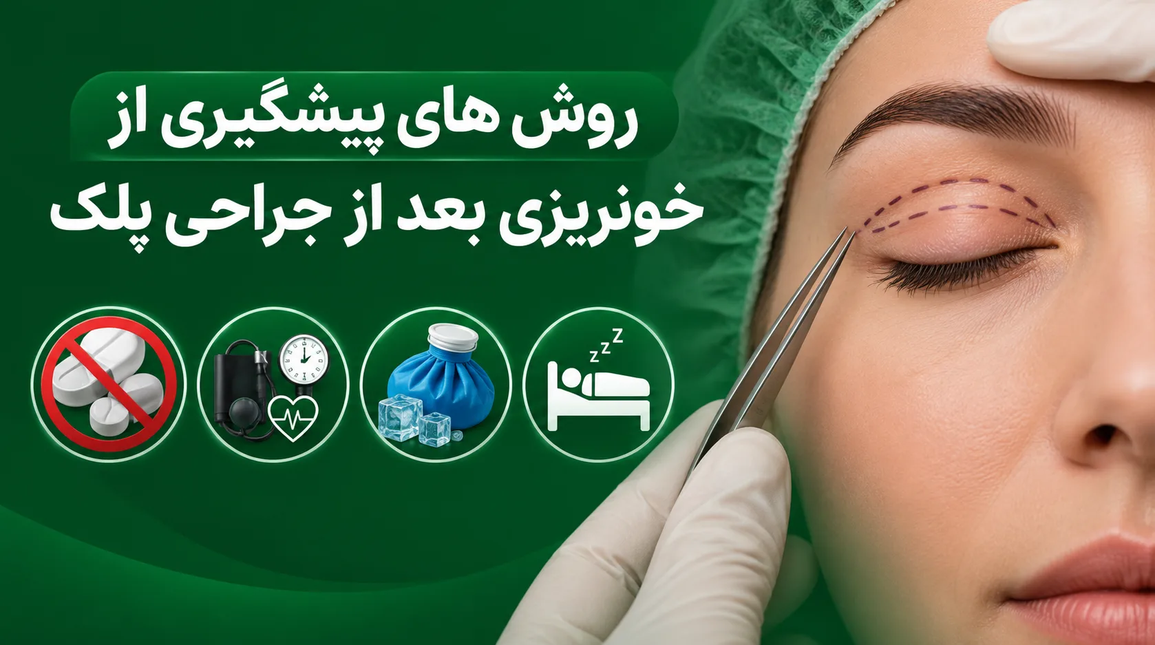 روش های پیشگیری از خونریزی بعد از جراحی پلک 