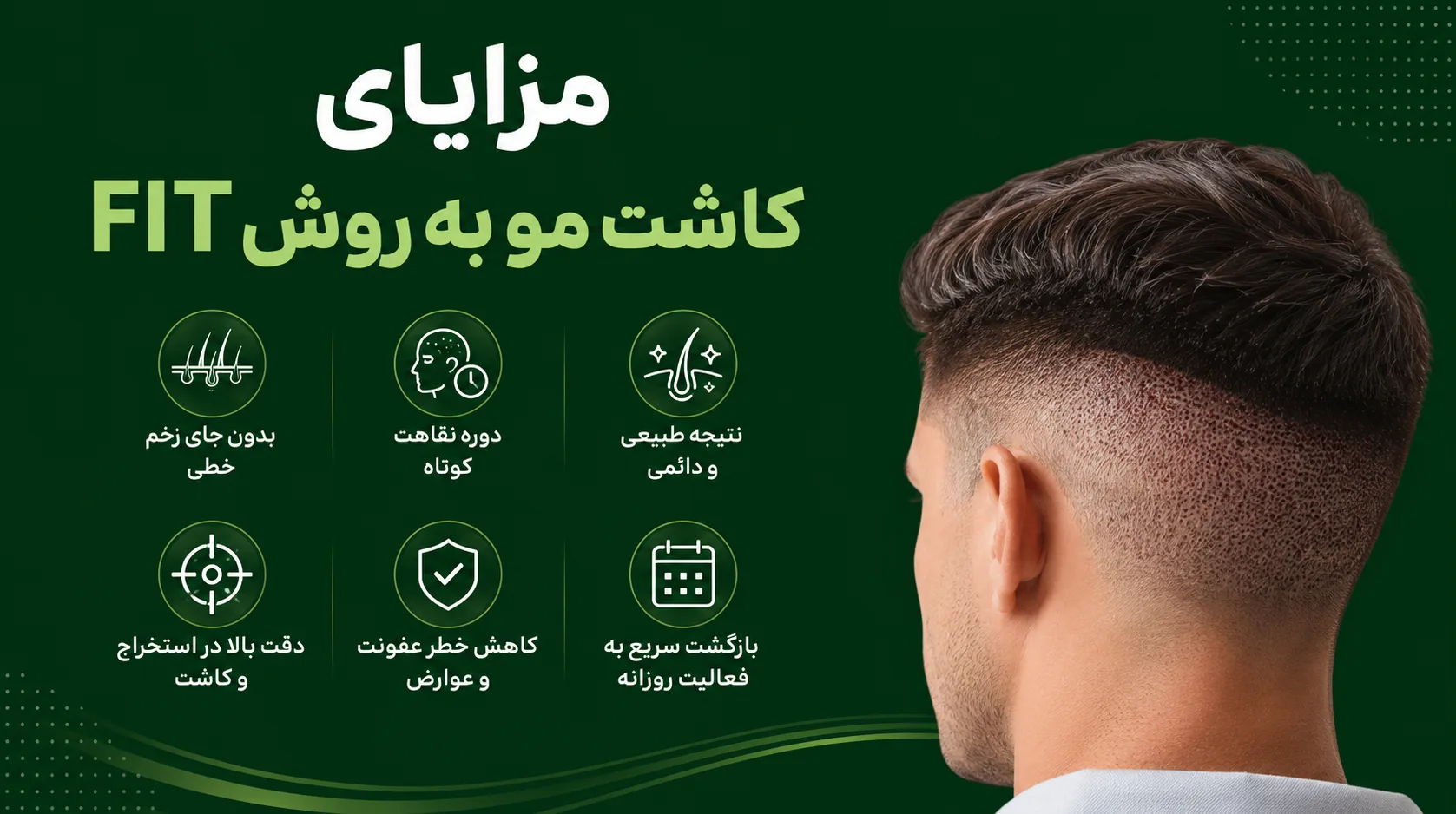 کاشت مو به روش FUT