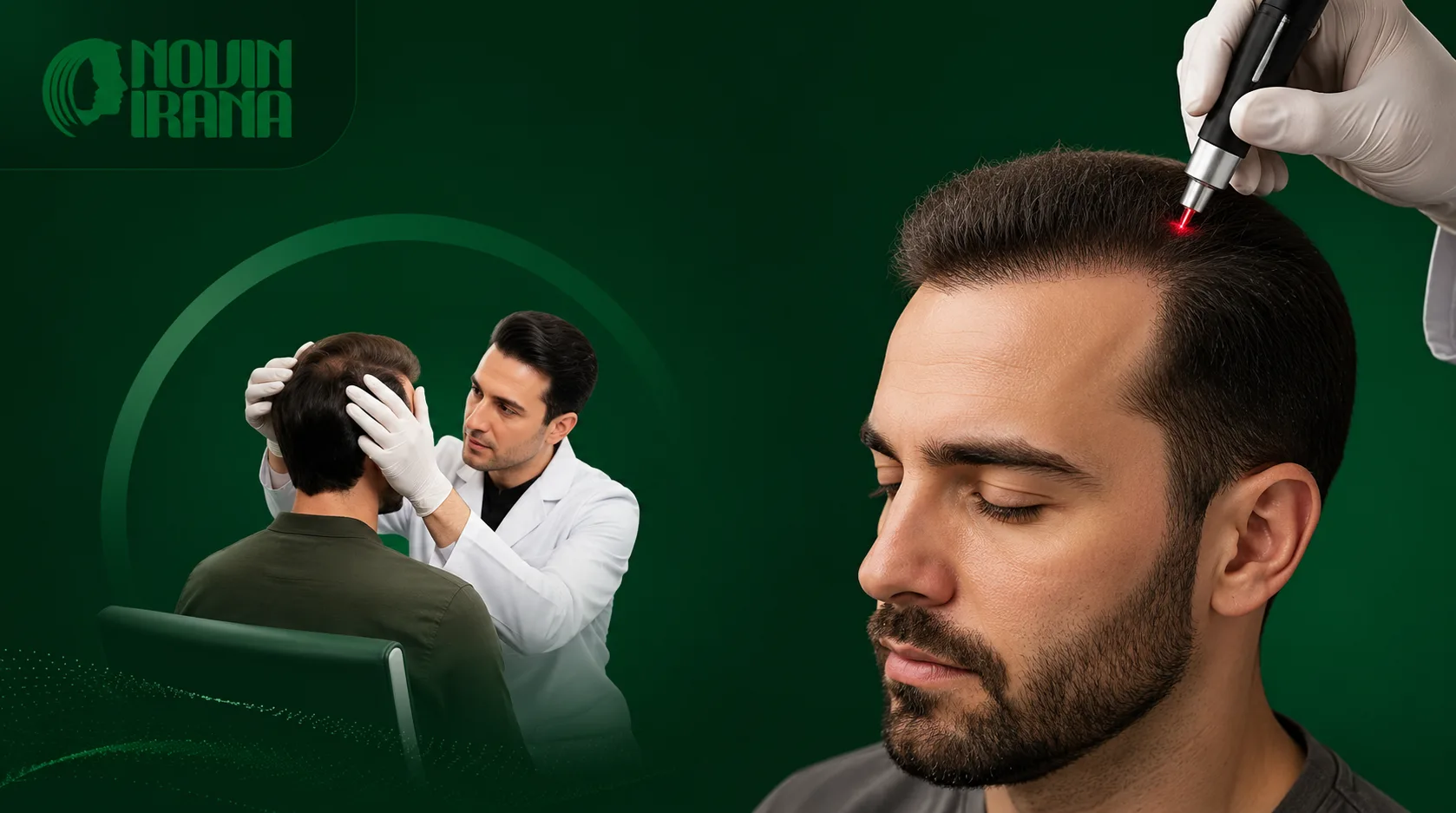 من هم المرشحون المناسبون لعلاج زراعه الشعر بالليزر؟