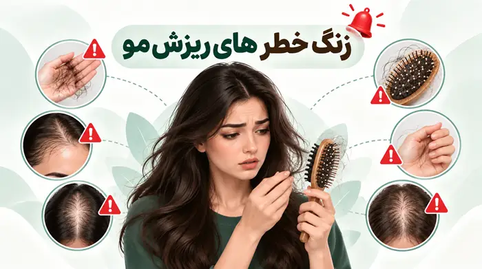 زنگ خطر های ریزش مو