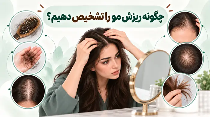 چگونه ریزش مو را تشخیص دهیم؟