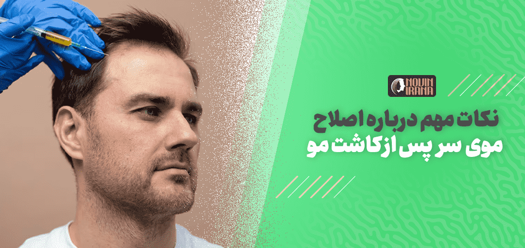 نکات مهم درباره اصلاح موی سر پس از کاشت مو - نوین ایرانا