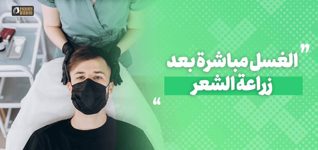الغسل مباشرة بعد زراعة الشعر